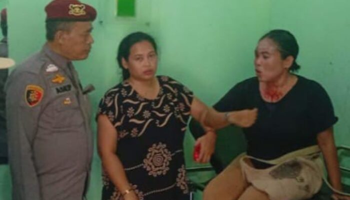 Premanisme Cemari Wisata Pantai Santolo, Pemilik Penginapan Jadi Korban Penganiayaan